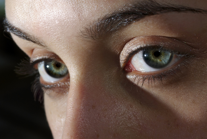 Close up image of eyes looking slightly off camera as the featured image for Causes of Thyroid Eye Disease