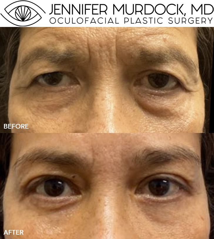 Cosmetic Cases Patient 2
