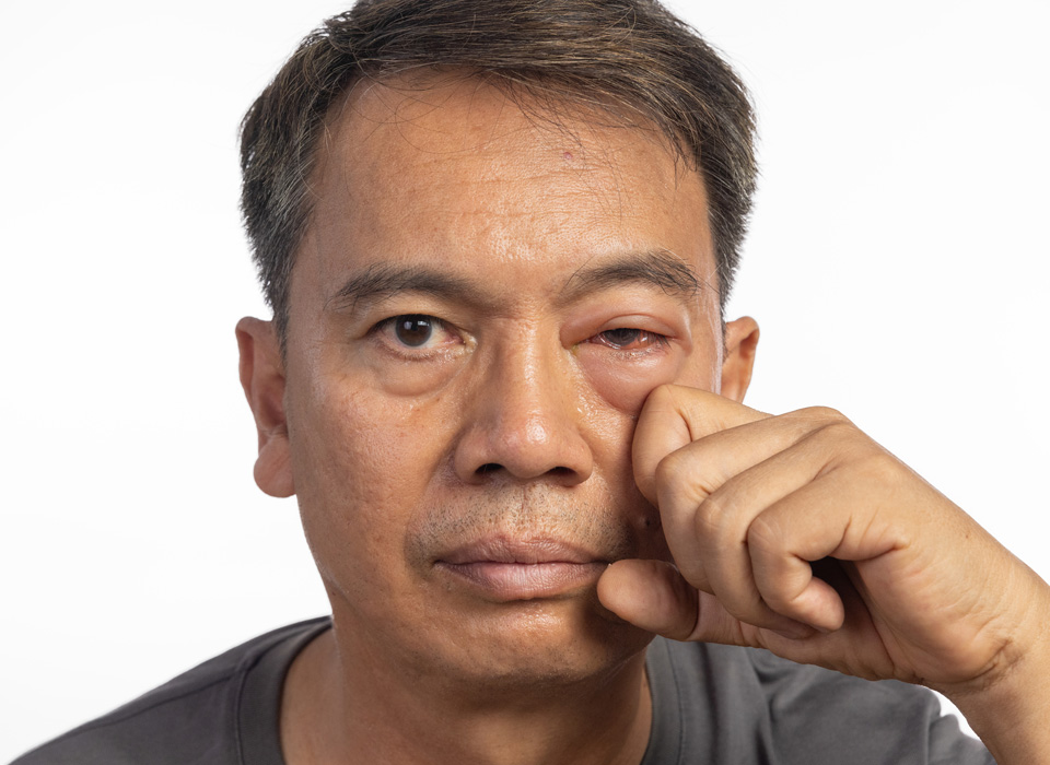 stock image of asian model showing his swallon eyes