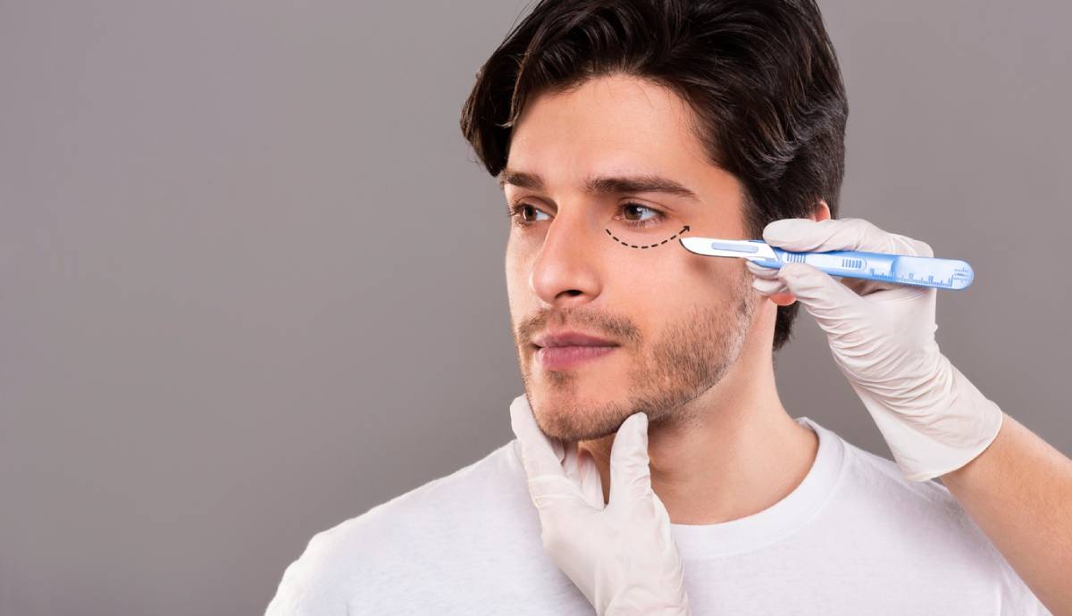 Featured image for How Do You Prepare for Eyelid Surgery?
