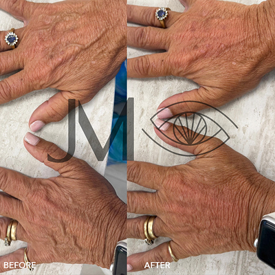 Cosmetic Injections Image